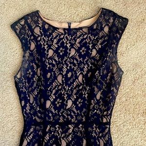 Beautiful lace dress 👗